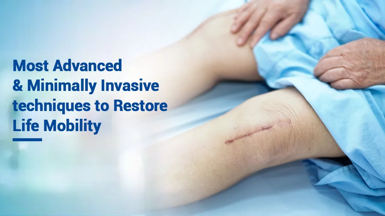 joint-replacement-arthroscopic