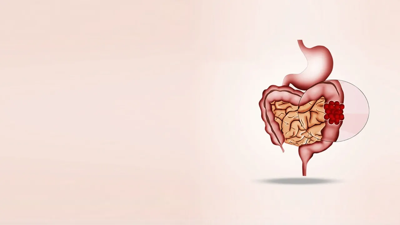 Colorectal surgery