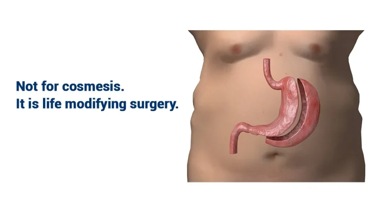 bariatric-and-metabolic-surgery